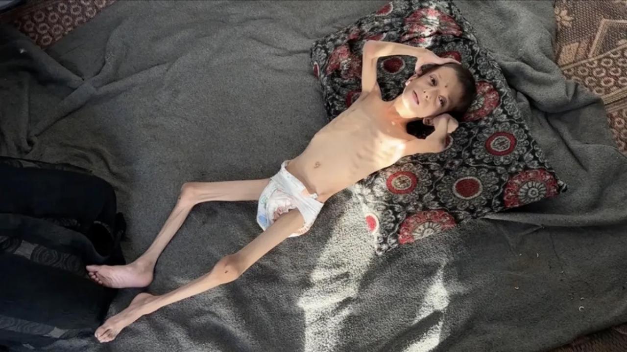 10 yasindaki gazzeli nafiz 4 aylik bebege donustu annesi tasimaya bile korkuyor xin7XSvL