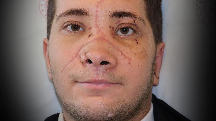 yedikleri burnundan gelecekti 19 yasindaki omerin ihmali arkadaslarim da ayni hatayi yapmasin r7sMCmgS